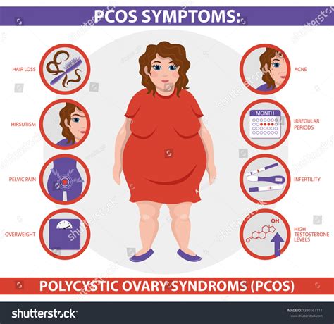 PCOS 증상 정보다낭성 난소증후군자세한 벡터 Infographic여성 스톡 벡터 로열티 프리 1380167111