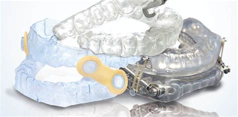 oral appliance therapy sleep education by aasm