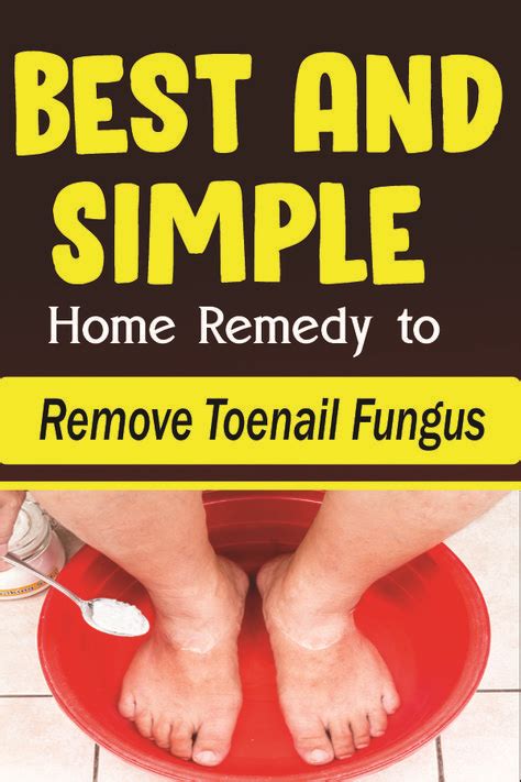 Best And Simple Home Remedy To Remove Toenail Fungus Health Articles