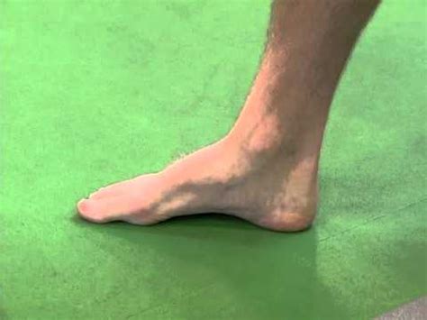 Feet) is an anatomical structure found in many vertebrates. Foot: Intrinsic: Doming - YouTube