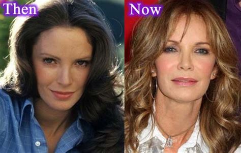 Jaclyn Smith Plastic Surgery Before And After Pictures