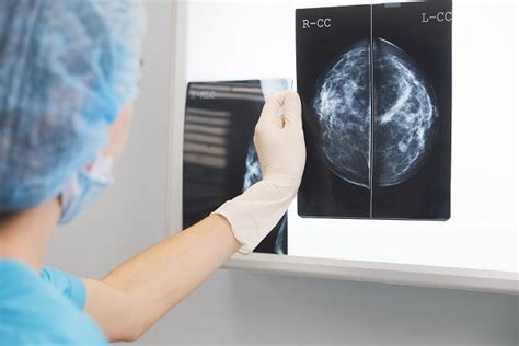 Researchers Have Unveiled Clues Into How Breast Cancer Cells Spread