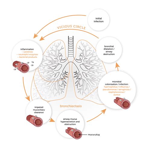 Pathophysiology Bronchiectasis