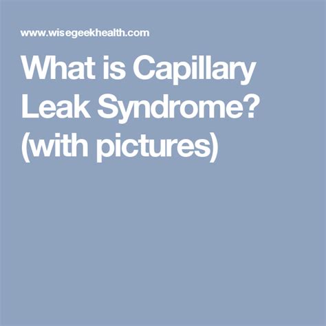 What Is Capillary Leak Syndrome With Pictures Syndrome Leaks Disease