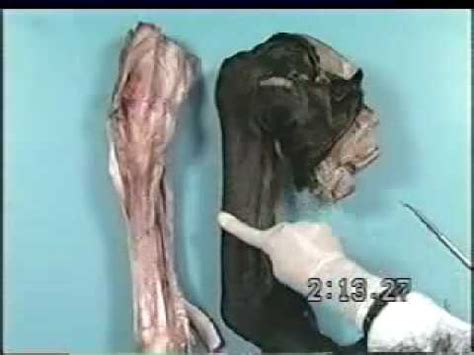 Bones and deep structures of equine thoracic limb 3 - YouTube