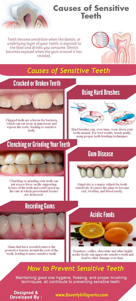 causes of sensitive teeth visual ly