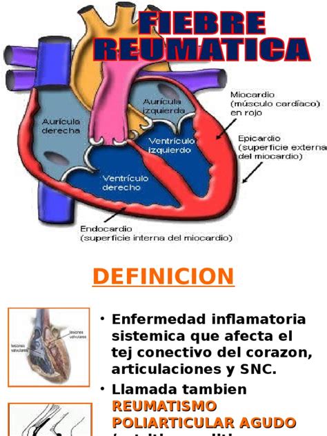 El saneamiento e higiene son las medidas críticas que deben tomarse para prevenir la fiebre tifoidea, debido a que la causa de la fiebre tifoidea es la falta de higiene. FIEBRE REUMATICA ABRIL 2014.ppt | Medicina CLINICA ...