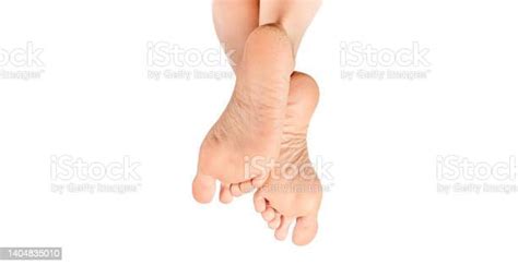 Dry And Cracked Soles Of Feet On White Background Dry Female Heels Rough Skin On Female Feet Dry