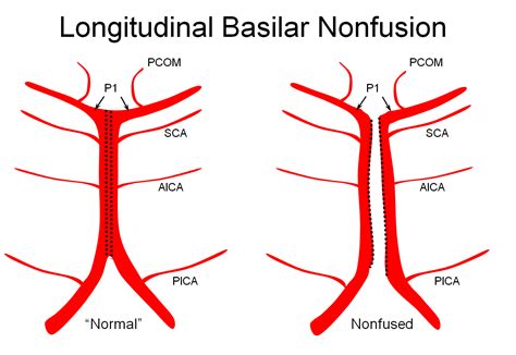 Basilar Artery