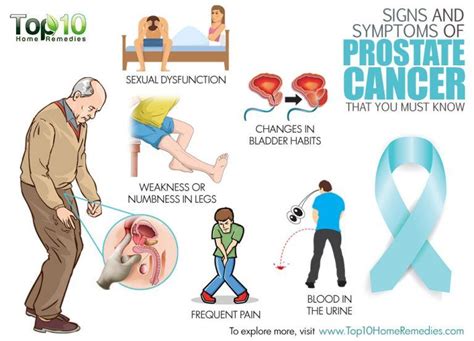 Signs And Symptoms Of Prostate Cancer That You Must Know Top 10 Home