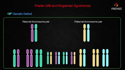 Prader Willi And Angelman Syndrome Usmle Acne Symptoms