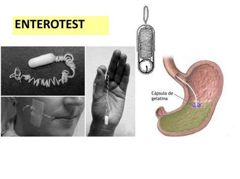 Ppt Giardia Lamblia Aka Giardia Intestinalis Or Giardia Duodenalis Powerpoint Presentation