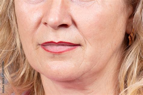 The Lower Part Of The Face And Neck Of An Elderly Woman With Signs Of