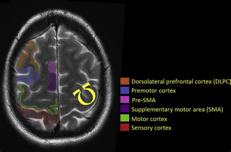 Functional Brain Anatomy Radiology Key