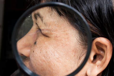 Facial hair in women may be caused by several factors, and dr. The Effects of Menopause on Skin