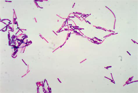 Bacillus Cereus Mechanisms Of Pathogenicity