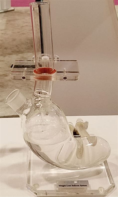 Maybe you would like to learn more about one of these? Plastic-Stomach-Model - Obesity Reporter