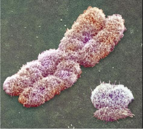 X Chromosome Test Paternity Testing Labs