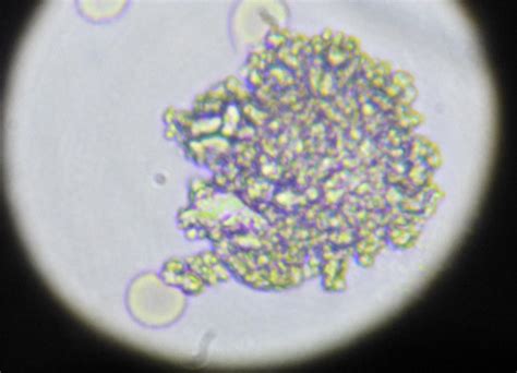 Bacteria Cell Under Microscope 40x Micropedia