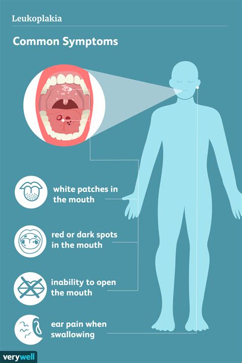 Leukoplakia Symptoms Causes Diagnosis And Treatment