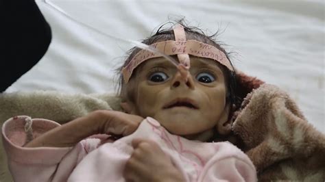 Starving Baby Shows Horrific Effects Of War In Yemen Itv News