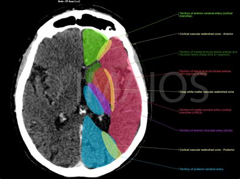 Brain And Face Ct Interactive Anatomy Atlas E Anatomy