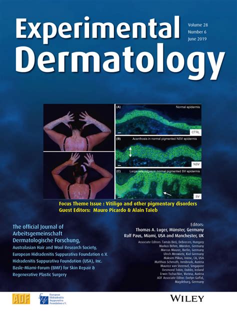 Experimental Dermatology Wiley Online Library