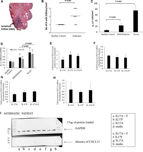 Il 17 Enhances The Migration Of B Cells During Asthma By Inducing