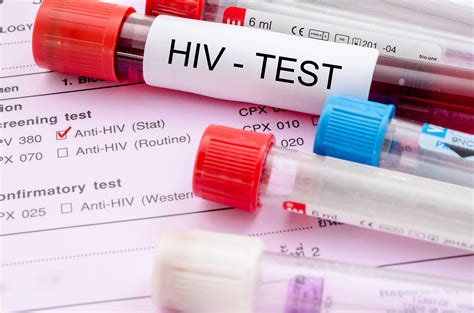 Hiv stands for human immunodeficiency virus. Rośnie liczba zakażonych wirusem HIV : Radio Olsztyn