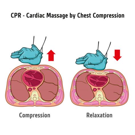 Cpr Drowning Illustrations Royalty Free Vector Graphics And Clip Art Istock