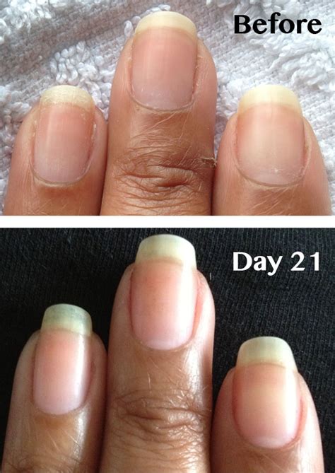 Peeling Nails Beckys Pure Nail Oil™ Results Nail Care Hq