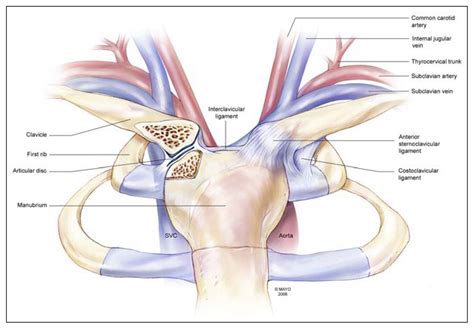 Posterior Sternoclavicular Joint Dislocation Cjs