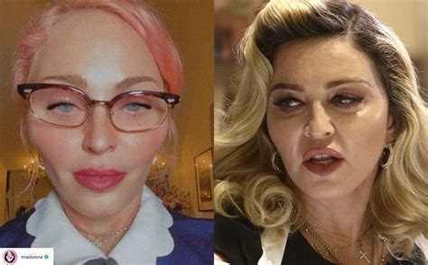 Madonna Przesadziła Z Operacjami Plastycznymi Twarzy Porównaj Zdjęcia