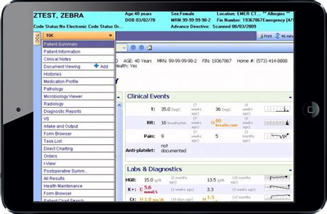 Epic Charting System