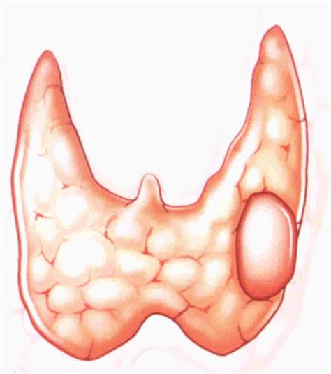 Généralités thyroïde Toulouse Thyroide