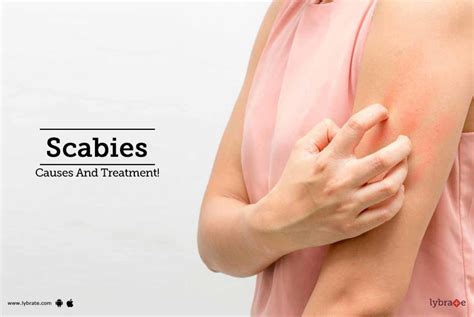 Scabies Causes And Treatment By Dr Anil P Trimbake Lybrate