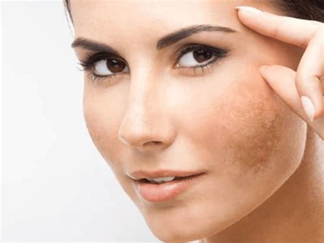 Aesthetic Dermatology Ms Skin Centre