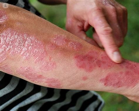 What Causes A Skin Rash Top Doctors