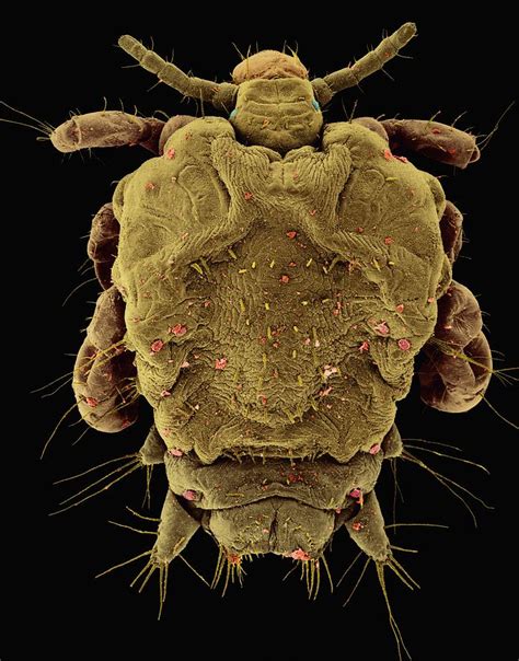 Lice Under Microscope