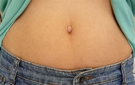 Innie Or Outie Understanding The Different Types Of Belly Buttons