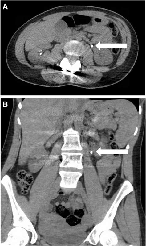 Representative Selection Of Ct Abdomen And Pelvis Images Showing