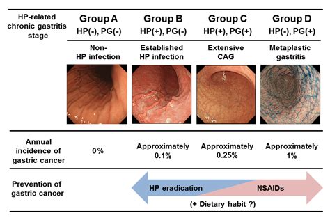 Gastric Ulcer Classification
