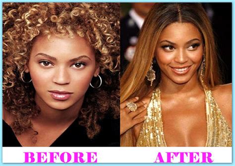 Transforming Queen Bey A Look At Beyoncé Before And After Plastic