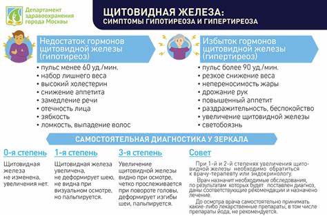 Дисфункция щитовидной железы. Симптомы, указывающие на патологию Картинка - Дисфункция щитовидной железы. Симптомы, указывающие на патологию