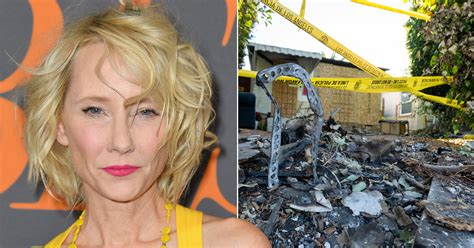 Anne Heche ‘stuck In Burning House For 45 Minutes Following Horror Car