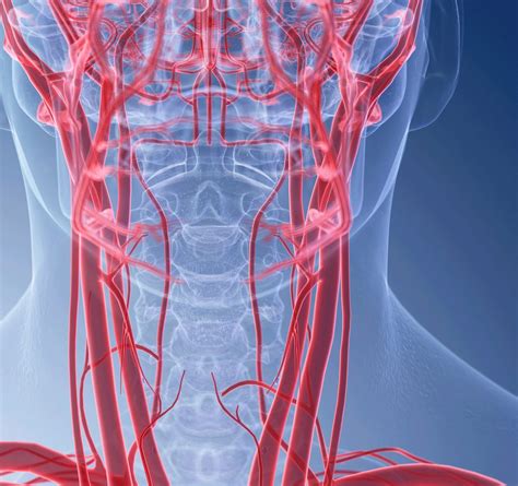 What Is Carotid Artery Disease Yourcareeverywhere