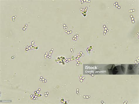 Budding Yeast Cells In Urine Stock Photo Download Image Now Yeast