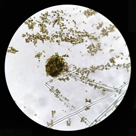 Conidial ( comparative more conidial, superlative most conidial). My World/ My Dimension • Conidial head of Aspergillus ...