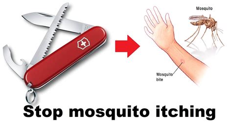 Victorinox First Aid Hackvid86 Stop Mosquito Bite Itching Youtube