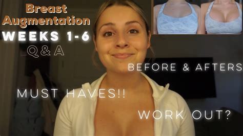 breast augmentation weeks 1 6 post op youtube